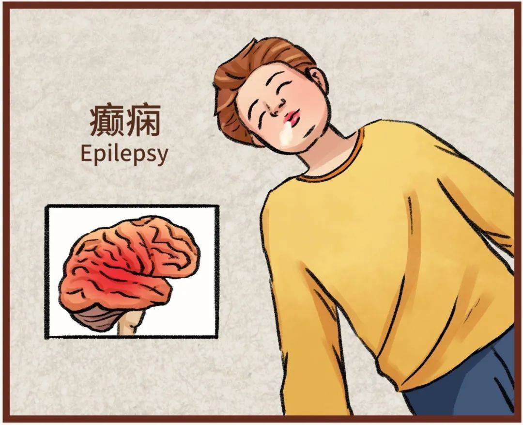 癫痫能治吗?答案在这里!