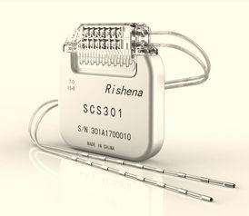 瑞神安医疗获数千万元A轮融资，自主研发有源植入神经刺激器为癫痫患者带来新希望